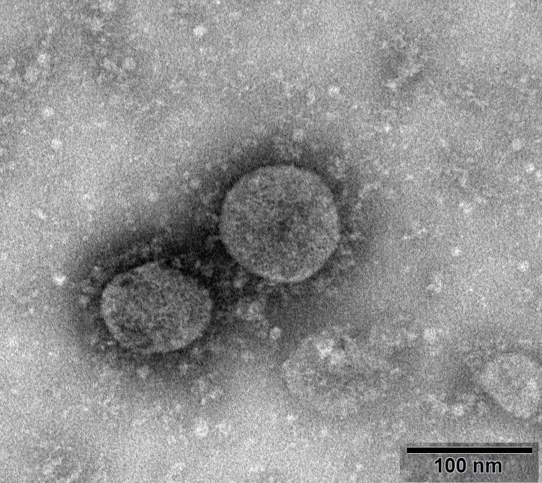 新型冠状病毒武汉株02  照片来源：国家病原微生物资源库（中国疾病预防控制中心病毒病预防控制所）