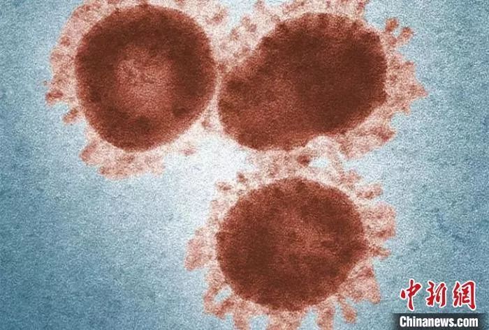 显微镜下的SARS冠状病毒（图片来源：www.cdc.gov） 中科院上海巴斯德所/供图