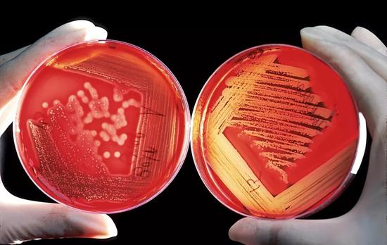 被葡萄球菌感染（左）和被链球菌感染（右）的红细胞